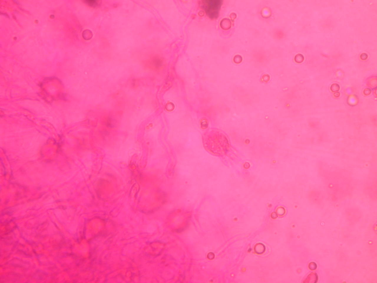Observation mo-30030, Pseudohydnum gelatinosum