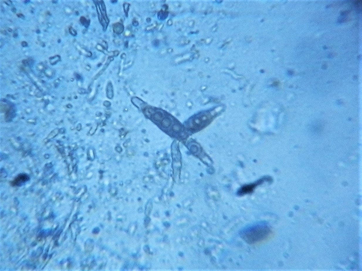 Observation mo-363586, Prosthemium betulinum