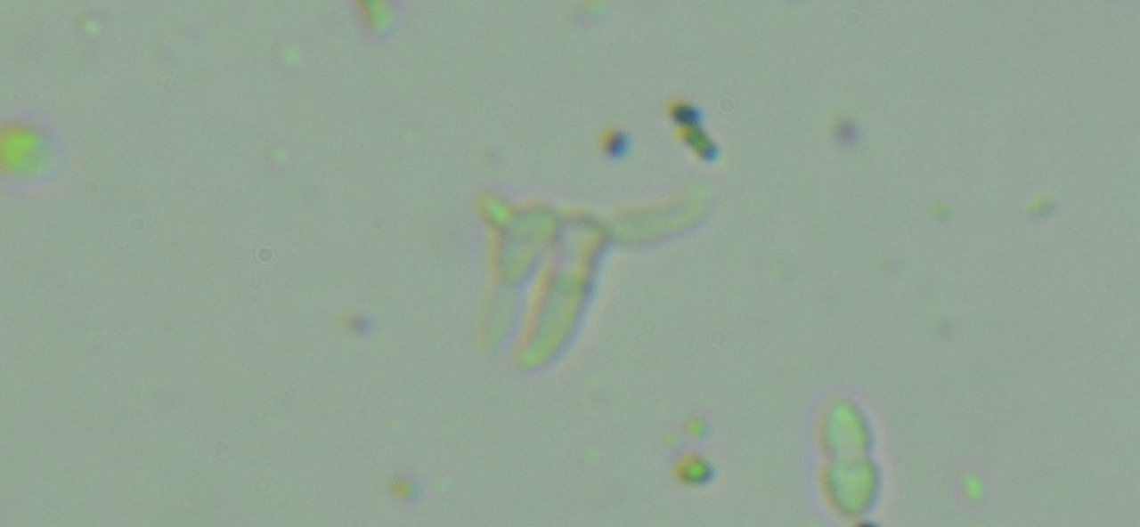 Observation mo-368523, Tripospermum camelopardus